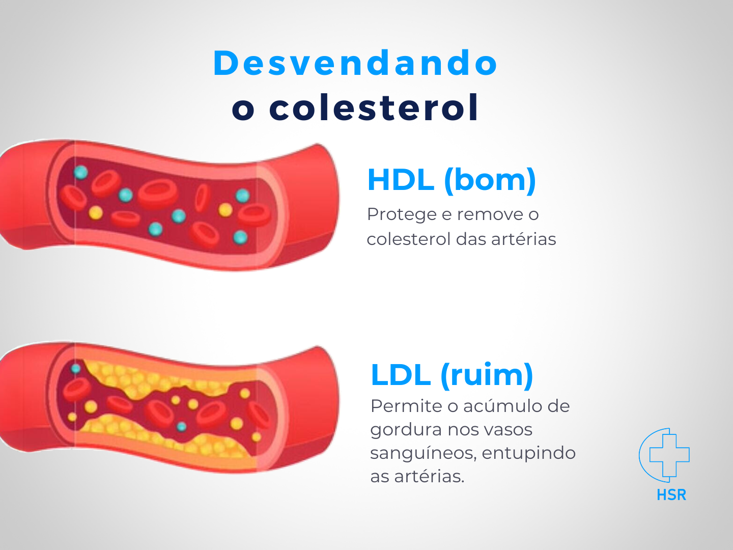 Avaliação do colesterol exige análise médica individual em Mato Grosso