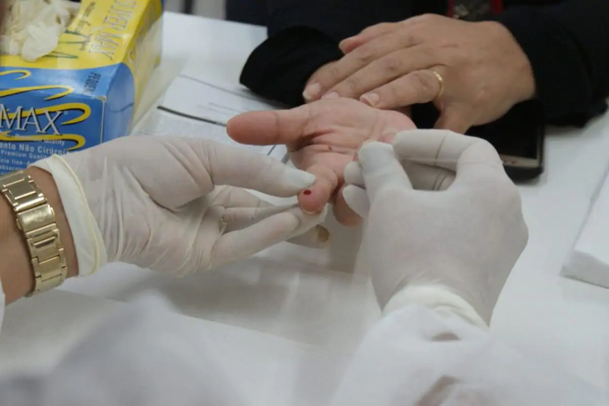 Casos de HIV e aids registram queda em Mato Grosso