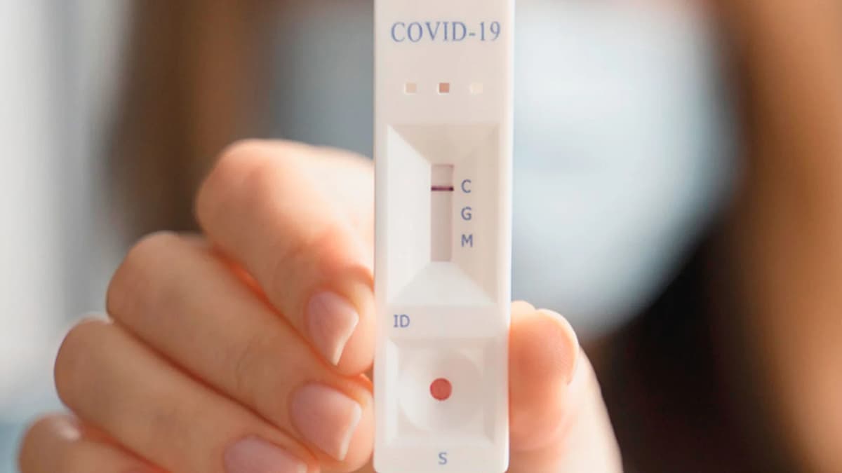 Mato Grosso enviará 70 mil testes rápidos de Covid-19 a cidades e hospitais