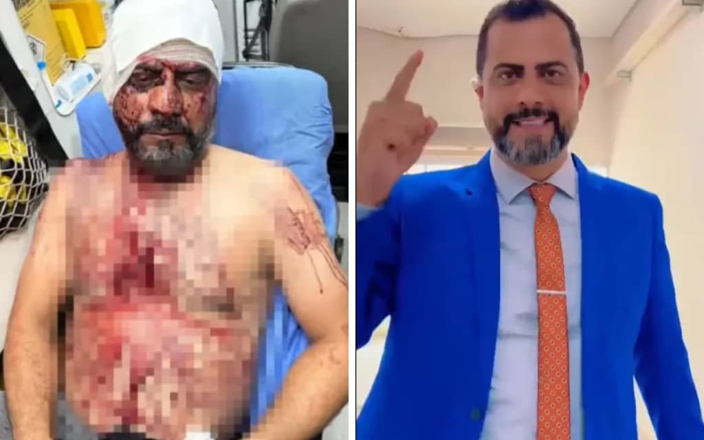 Vereador baleado e torturado volta à Câmara em Rondonópolis MT